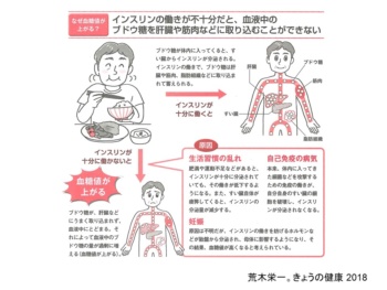 糖尿病について のむらニューロスリープクリニック 内科 神経内科 睡眠障害外来